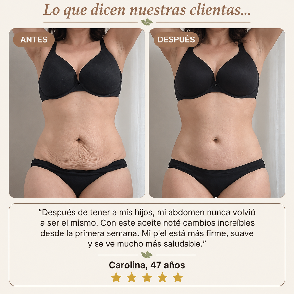 Aceite Corporal Reafirmante - Combate Celulitis, Flacidez y Arrugas