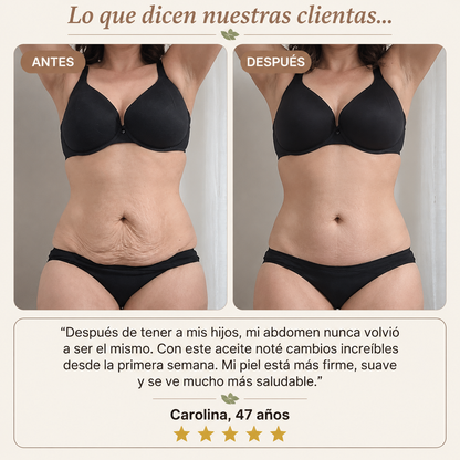Aceite Corporal Reafirmante - Combate Celulitis, Flacidez y Arrugas