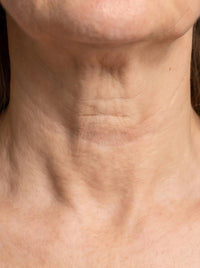 CUELLO