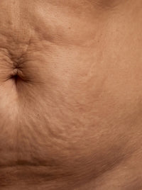 ABDOMEN