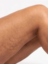 PIERNAS